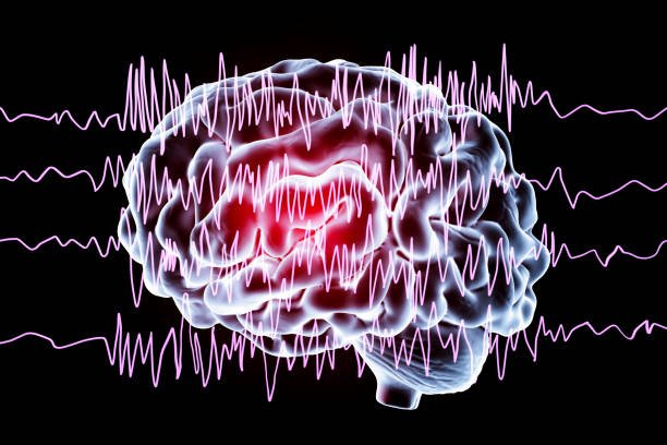 Neurology - epilepsy-and-seizures